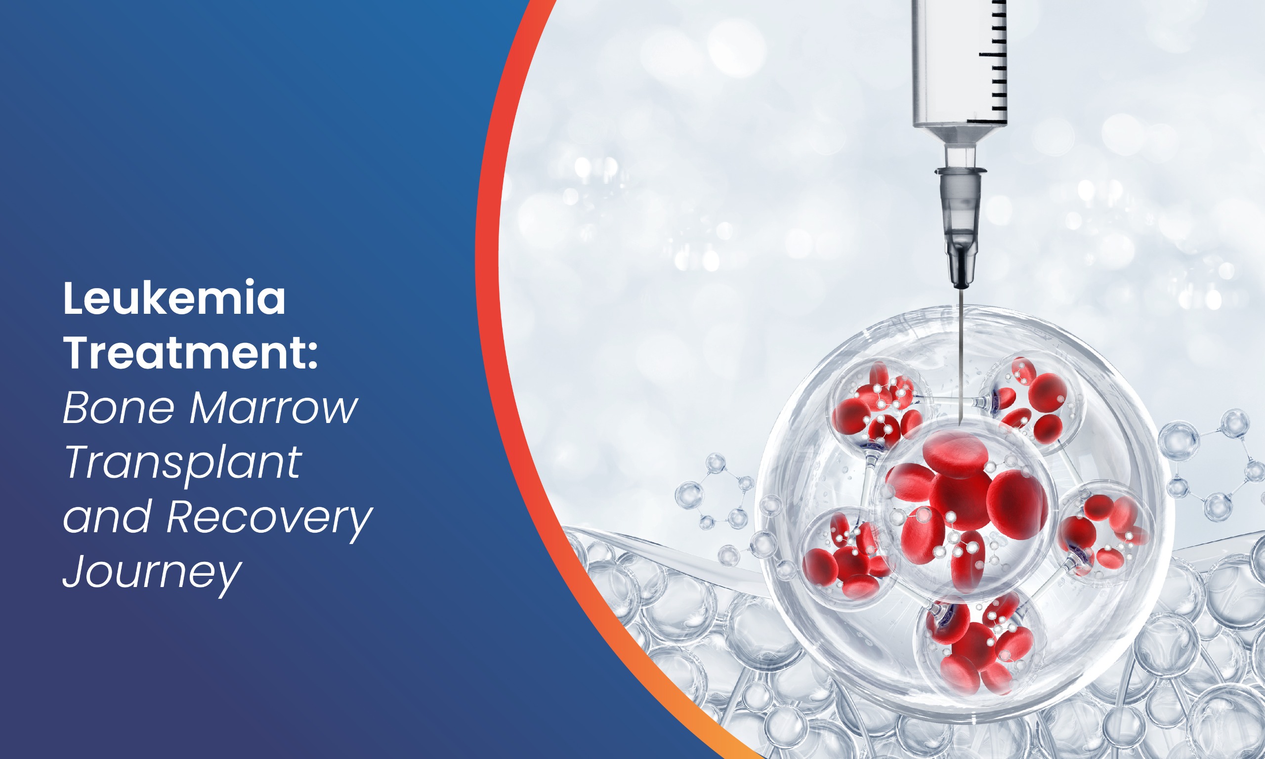 Bone Marrow Transplant for Leukemia: Treatment and Benefits