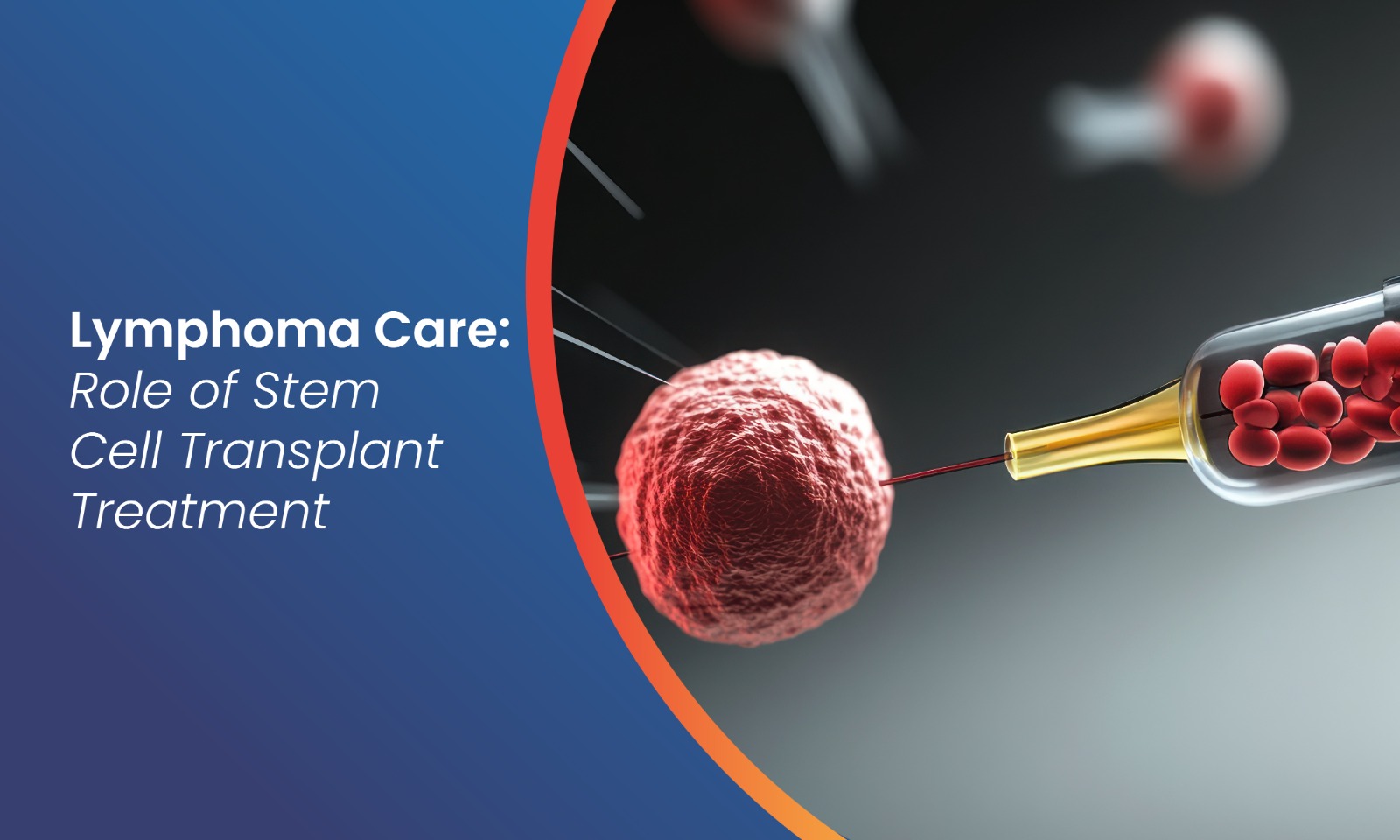 Bone Marrow Transplant for Lymphoma: Treatment & Benefits