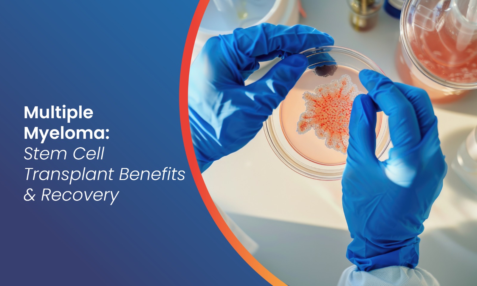 Stem Cell Transplant for Multiple Myeloma Benefits & Recovery