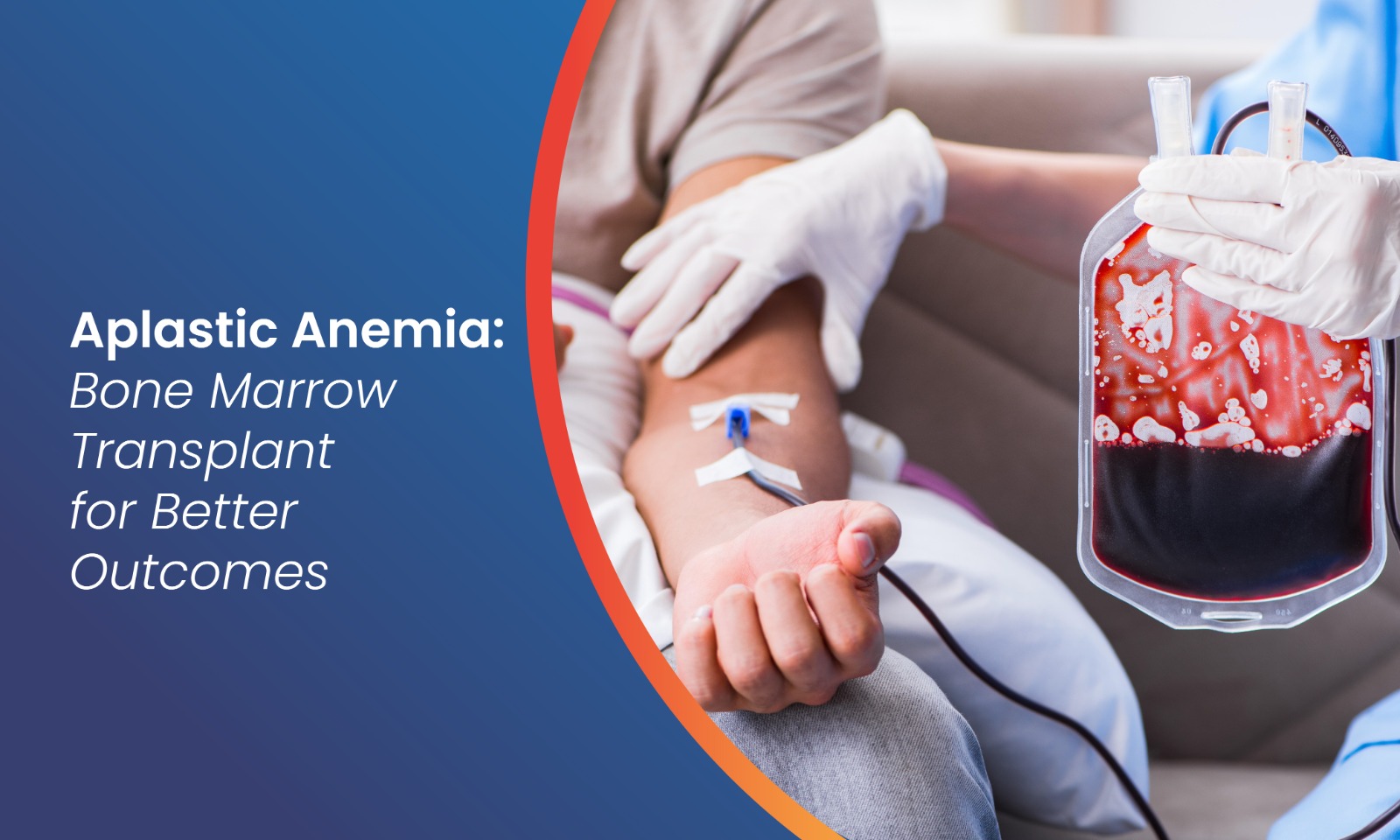 Bone Marrow Transplant for Aplastic Anemia Treatment Guide