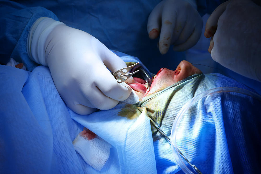 Maxillofacial Trauma Surgery