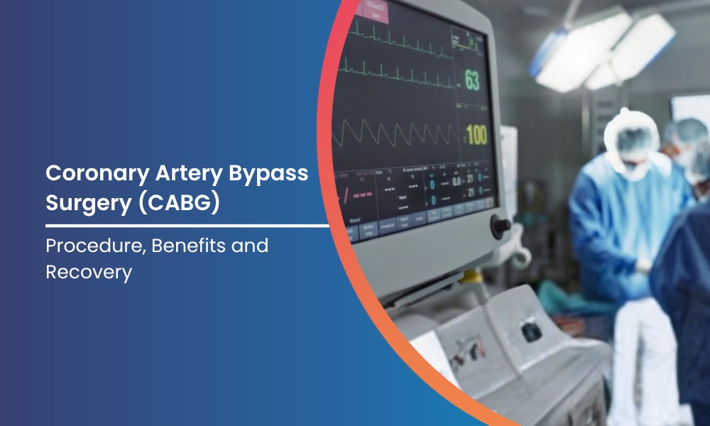 Coronary Artery Bypass Surgery Benefits and Recovery Guide