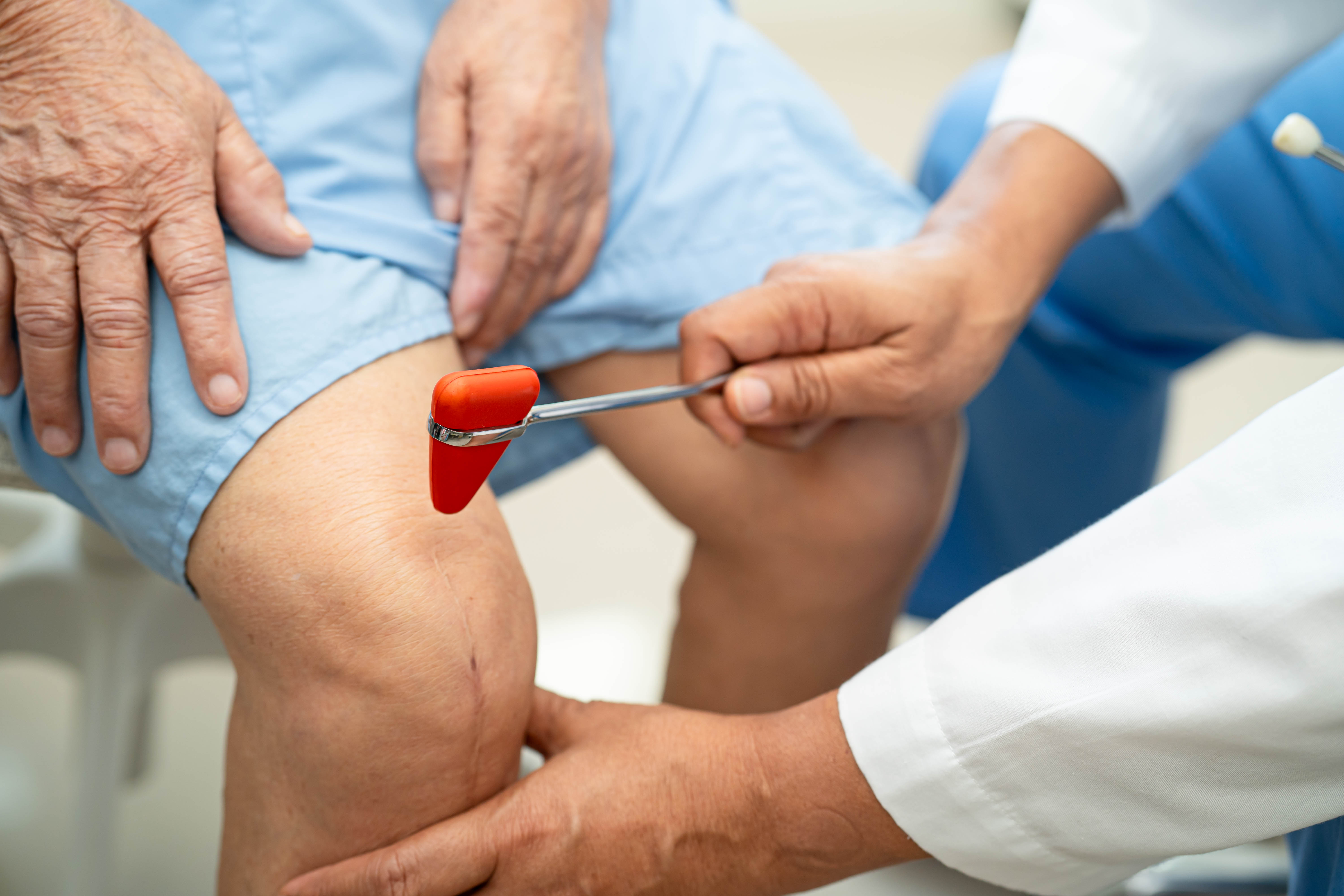 Autologous Bone Marrow Transplant