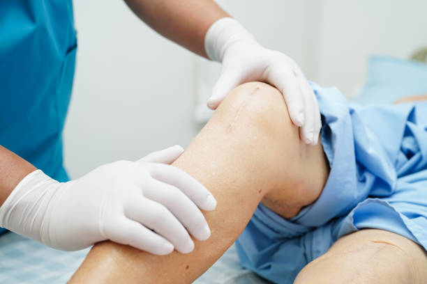 Knee Replacement Surgery