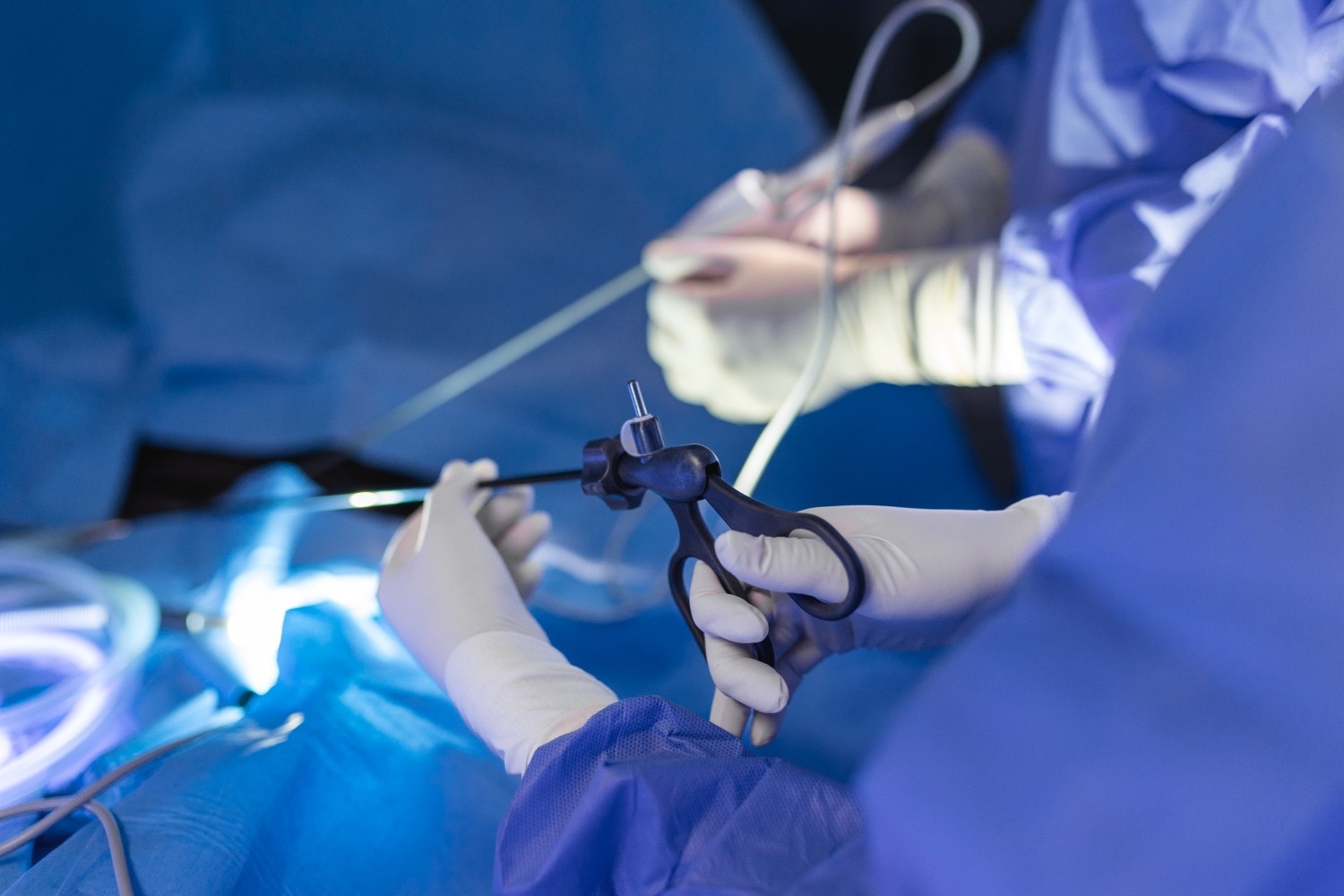 Laparoscopic Cholecystectomy